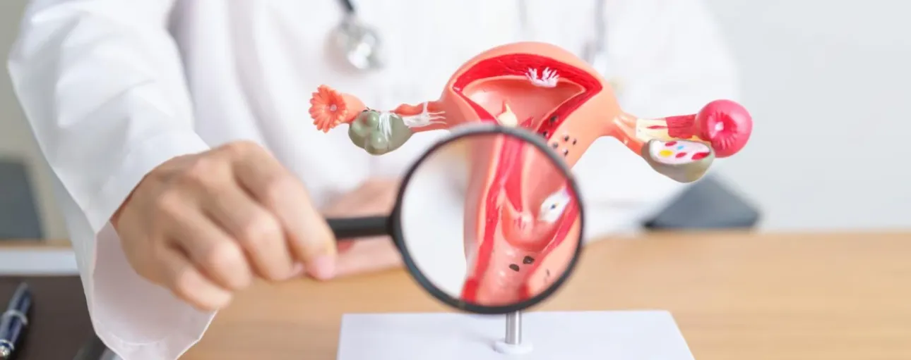 Periods, fibroid & Cyst care 1